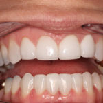 open mouth dental exam