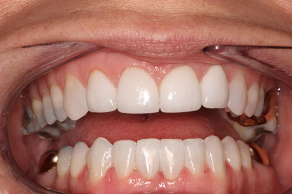 open mouth dental exam